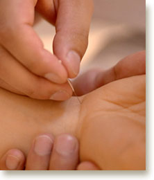 acupuncture_pht.jpg